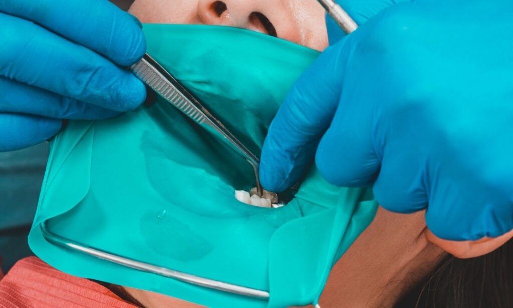 Aislamiento absoluto con dique de goma en clínica dental Dentarlet Recoleta